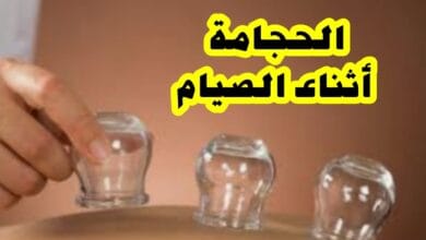 الحجامة ومباشرة المرأة أثناء الصيام